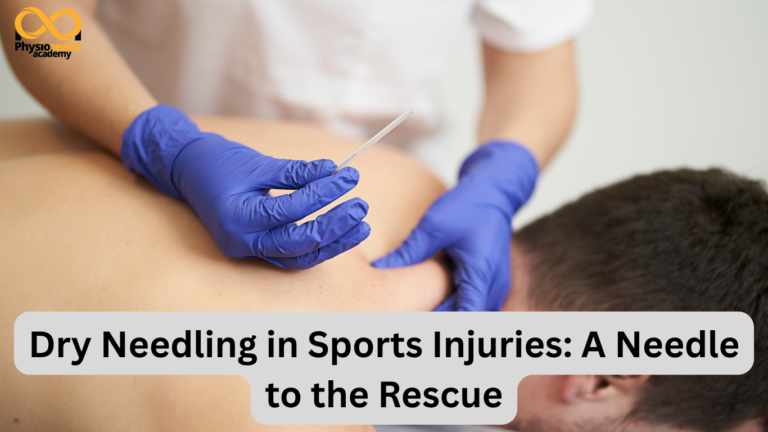 Dry Needling in Sports Injuries: A Needle to the Rescue