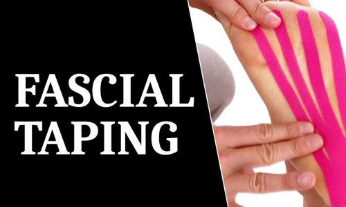 FASCIAL TAPING